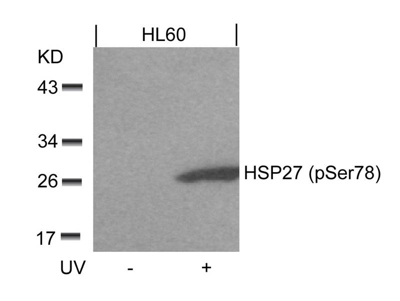 Rabbit Polyclonal Antibody to HSP27(Phospho-Ser78)