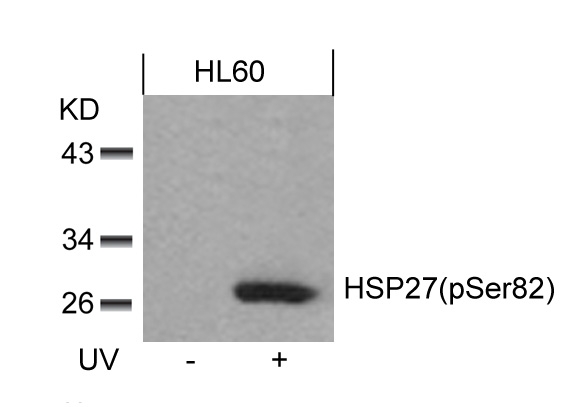 Rabbit Polyclonal Antibody to HSP27(Phospho-Ser82)