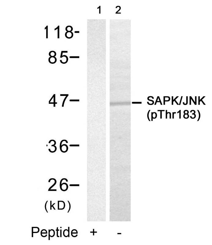 Rabbit Polyclonal Antibody to SAPK/JNK(Phospho-Thr183)