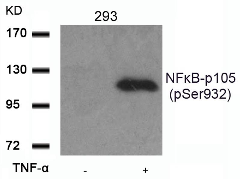 Rabbit Polyclonal Antibody to NFkB-p105(Phospho-Ser932)
