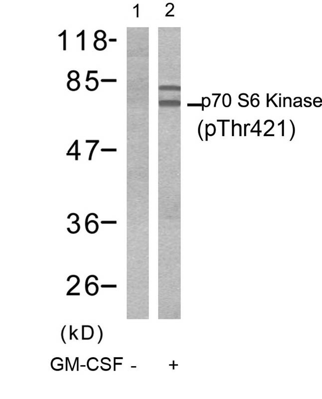 Rabbit Polyclonal Antibody to p7S6 Kinase(Phospho-Thr421)