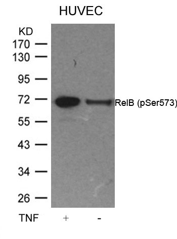 Rabbit Polyclonal Antibody to RelB(Phospho-Ser573)