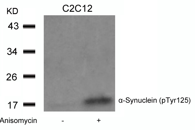 Rabbit Polyclonal Antibody to a-Synuclein(Phospho-Tyr125)