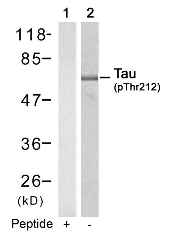 Rabbit Polyclonal Antibody to Tau(Phospho-Thr212)