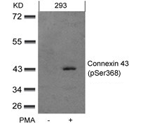 Rabbit Polyclonal Antibody to Connexin 43 (phospho-Ser368)