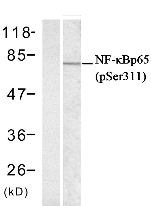 Rabbit Polyclonal Antibody to NFkB-p65 (phospho-Ser311)