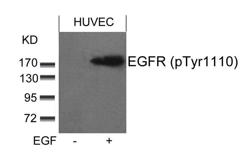 Rabbit Polyclonal Antibody to EGFR(phospho-Tyr1110)