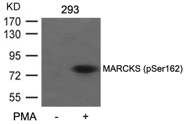 Rabbit Polyclonal Antibody to MARCKS(Phospho-Ser162)