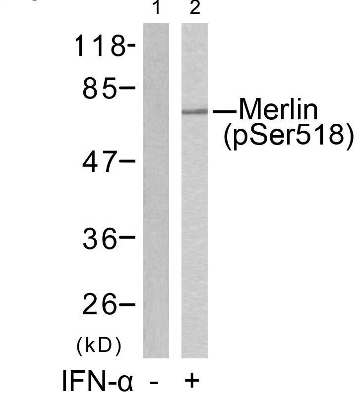 Rabbit Polyclonal Antibody to Merlin(Phospho-Ser518)