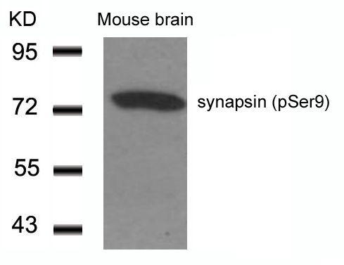 Rabbit Polyclonal Antibody to synapsin(Phospho-Ser9)