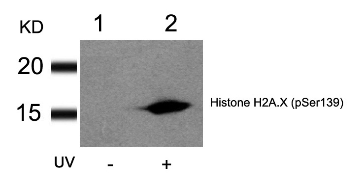 Rabbit Polyclonal Antibody to Histone H2A.X(Phospho-Ser139)