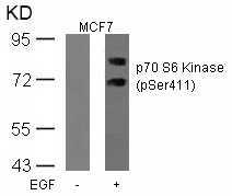 Rabbit Polyclonal Antibody to p7S6 Kinase(Phospho-Ser411)