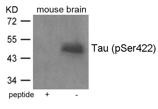 Rabbit Polyclonal Antibody to Tau(Phospho-Ser422)