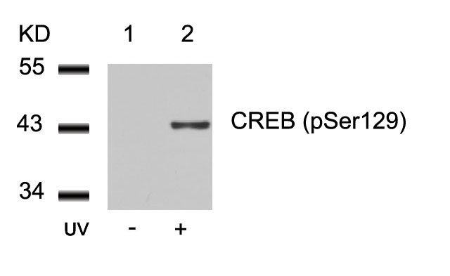 Rabbit Polyclonal Antibody to CREB(Phospho-Ser129)