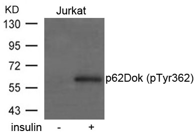 Rabbit Polyclonal Antibody to p62Dok(phospho-Tyr362)