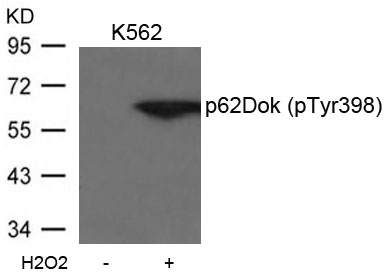 Rabbit Polyclonal Antibody to p62Dok(phospho-Tyr398)