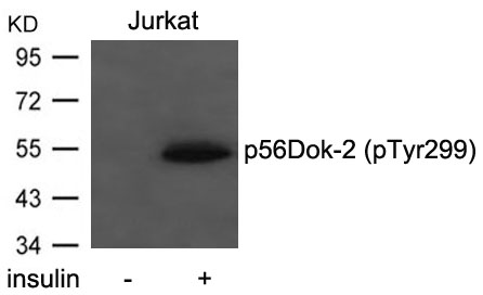 Rabbit Polyclonal Antibody to p56Dok-2(Phospho-Tyr299)