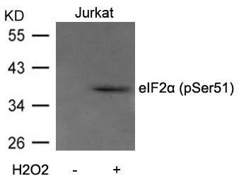 Rabbit Polyclonal Antibody to eIF2a(Phospho-Ser51)