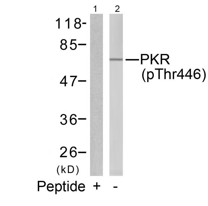 Rabbit Polyclonal Antibody to PKR(Phospho-Thr446)