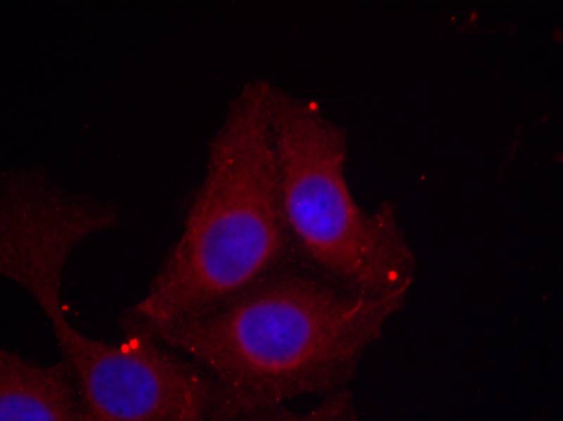 Rabbit Polyclonal Antibody to GAP43(Phospho-Ser41)