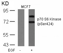 Rabbit Polyclonal Antibody to p7S6 Kinase(Phospho-Ser424)