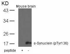 Rabbit Polyclonal Antibody to a-Synuclein(Phospho-Tyr136)