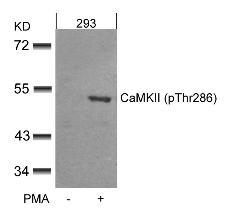 Rabbit Polyclonal Antibody to CaMKII(Phospho-Thr286)