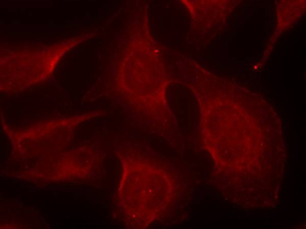 Rabbit Polyclonal Antibody to BIM(Phospho-Ser69)
