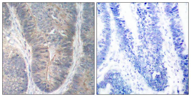 Rabbit Polyclonal Antibody to PKR(Phospho-Thr451)