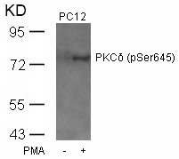 Rabbit Polyclonal Antibody to PKCd(Phospho-Ser645)