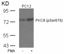 Rabbit Polyclonal Antibody to PKCth(Phospho-Ser676)