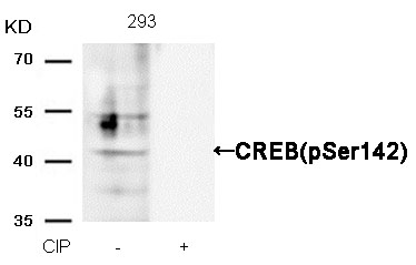 Rabbit Polyclonal Antibody to CREB(Phospho-Ser142)