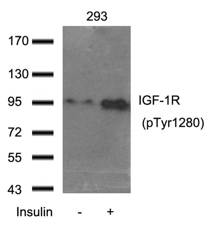 Rabbit Polyclonal Antibody to IGF-1R(Phospho-Tyr1280)