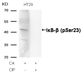 Rabbit Polyclonal Antibody to IkB-b(Phospho-Ser23)