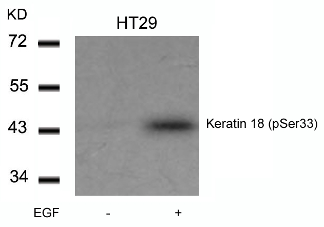 Rabbit Polyclonal Antibody to Keratin 18(Phospho-Ser33)