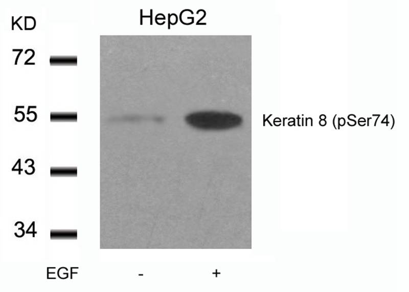 Rabbit Polyclonal Antibody to Keratin 8(Phospho-Ser74)