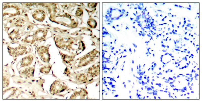 Rabbit Polyclonal Antibody to MEF2a(Phospho-Ser408)