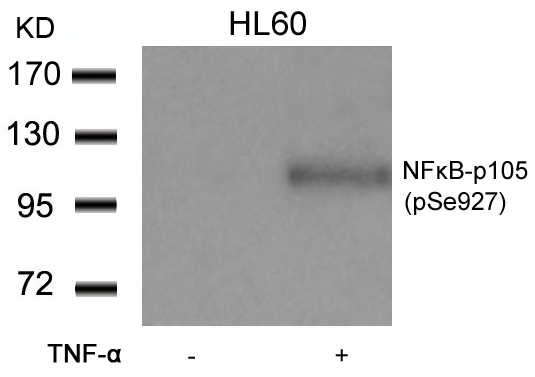 Rabbit Polyclonal Antibody to NFkB-p105(Phospho-Ser927)
