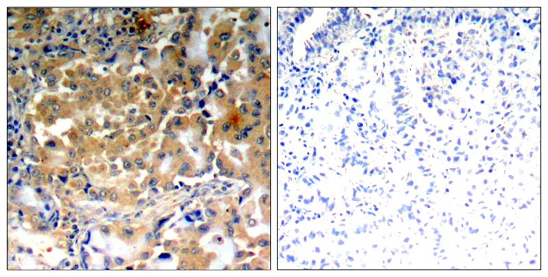 Rabbit Polyclonal Antibody to PKCζ(Phospho-Thr410)