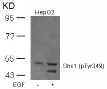 Rabbit Polyclonal Antibody to Shc1(Phospho-Tyr349)