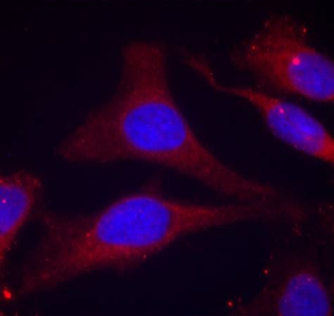 Rabbit Polyclonal Antibody to SHP-1(Phospho-Tyr536)