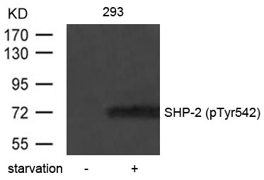 Rabbit Polyclonal Antibody to SHP-2(Phospho-Tyr542)