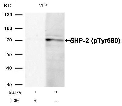 Rabbit Polyclonal Antibody to SHP-2(Phospho-Tyr580)