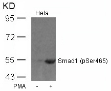 Rabbit Polyclonal Antibody to Smad1(Phospho-Ser465)