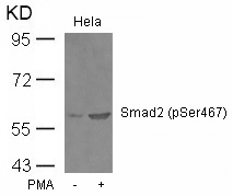 Rabbit Polyclonal Antibody to Smad2(Phospho-Ser467)
