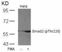 Rabbit Polyclonal Antibody to Smad2(Phospho-Thr220)