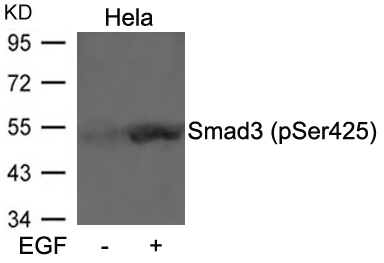 Rabbit Polyclonal Antibody to Smad3(Phospho-Ser425)