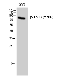 Rabbit Polyclonal Antibody to TrkB(Phospho-Tyr706)