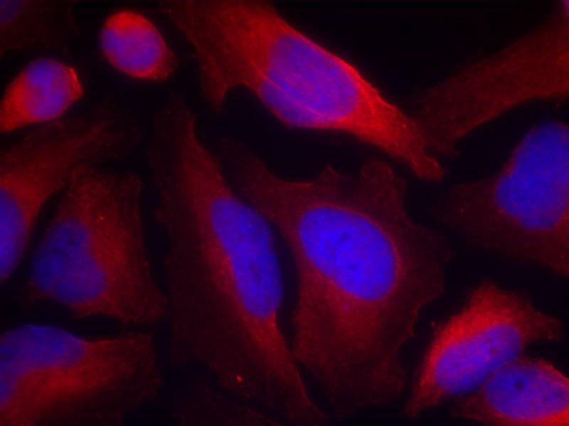 Rabbit Polyclonal Antibody to Tyrosine Hydroxylase(Phospho-Ser19)