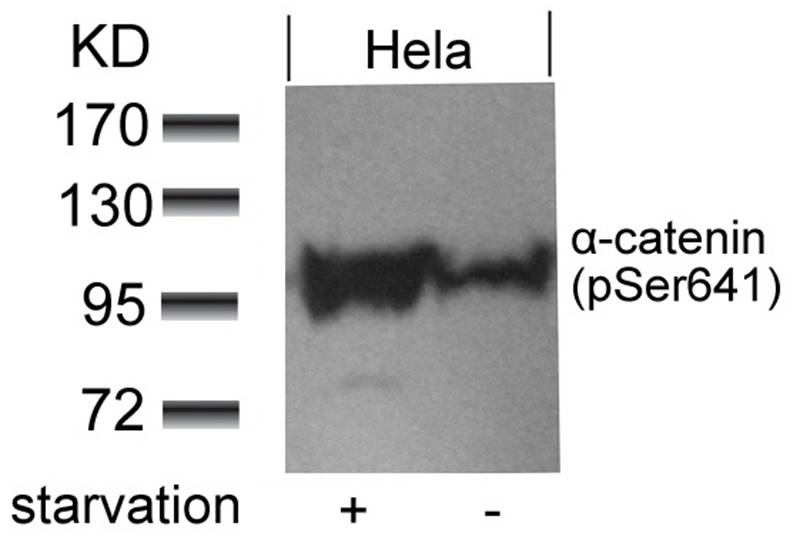 Rabbit Polyclonal Antibody to a-catenin(Phospho-Ser641)